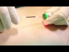 Machine de lipolyse au laser